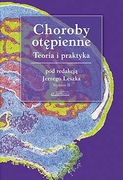 Choroby ot�pienne. Teoria i praktyka. Wydanie II
